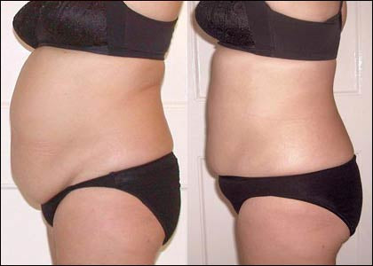 Love The Firm Body ♥️