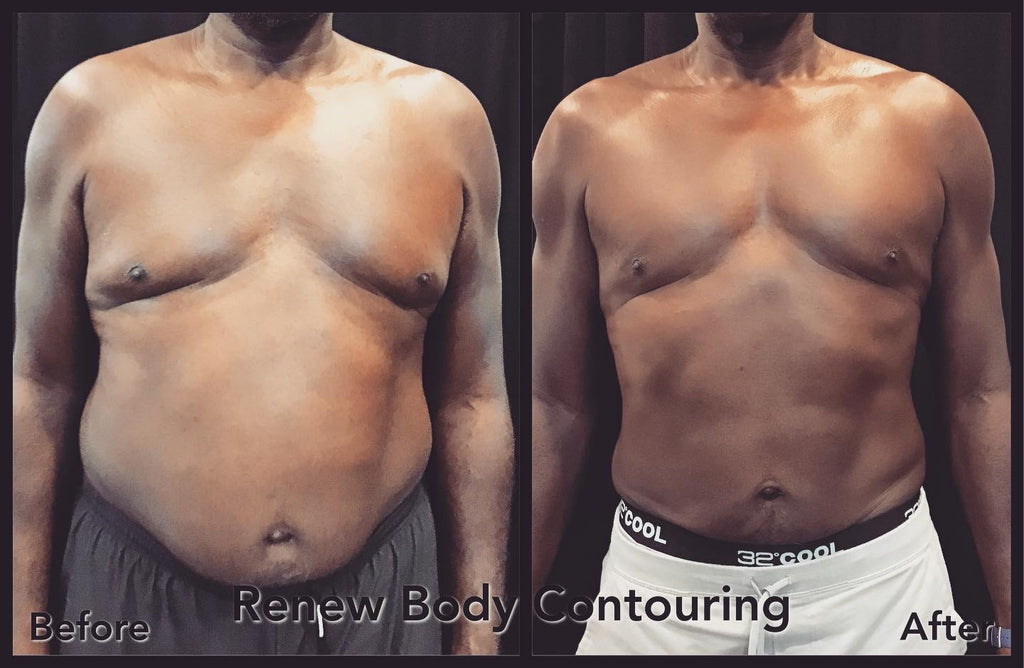 Get ready to sculpt and tighten your way to a fabulous summer with our exclusive special!