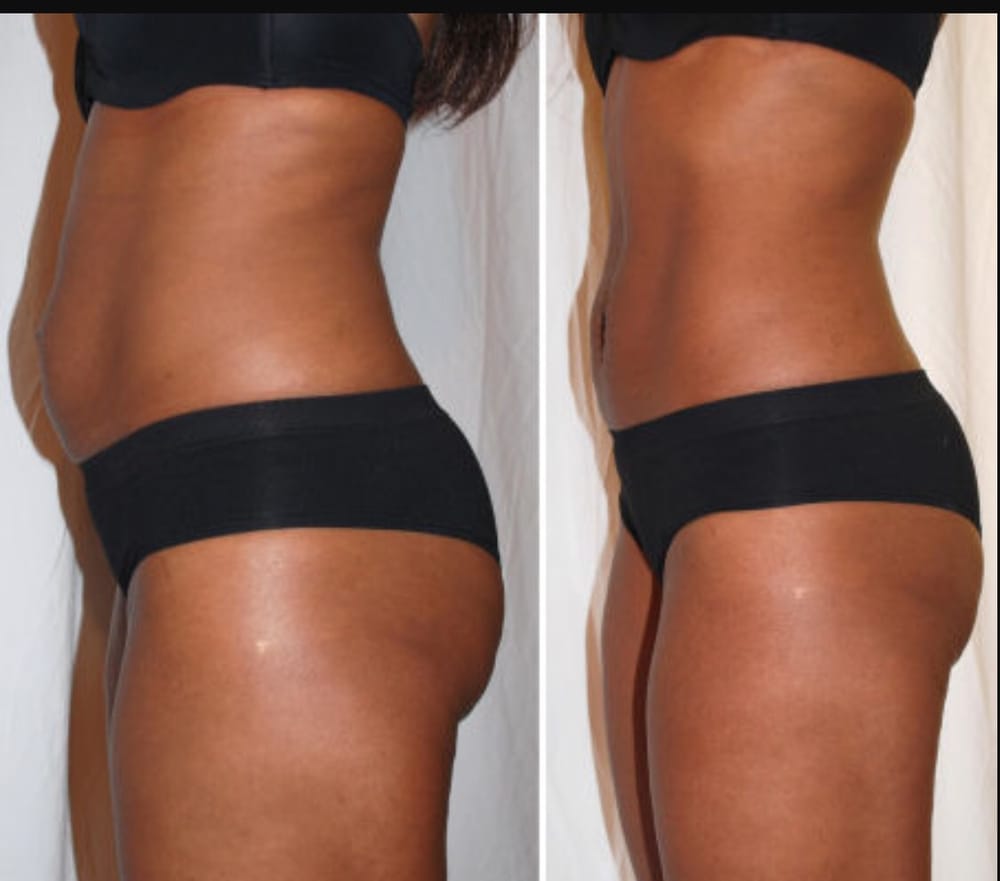 Love The Firm Body ♥️