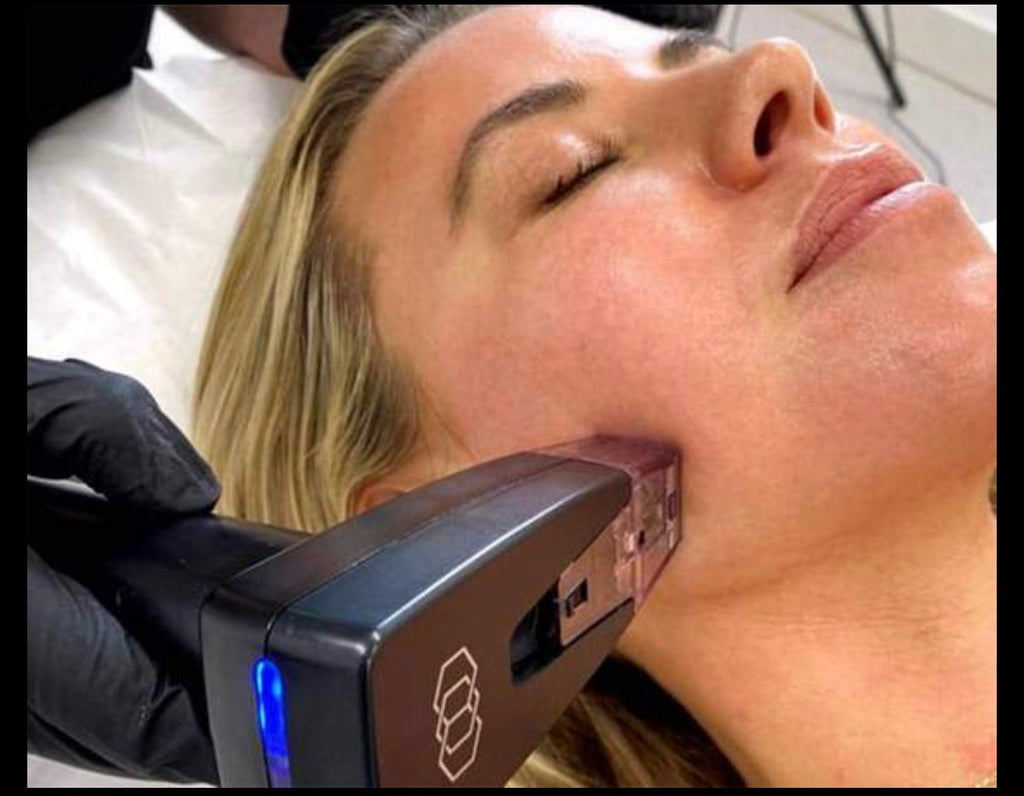 🎄 Morpheus8, Fractora, or PLEXR Plasma Face & Neck – 3 Treatments! ✨ Look Your Best This Year & Into 2026!