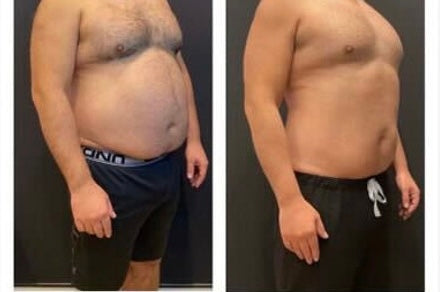 ✨ Keep the Holidays on the Table—Not on Your Waistline With 4 Different GLP Options!