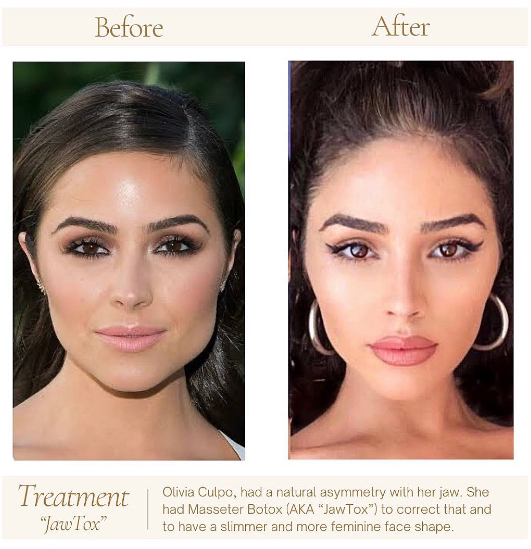 🎄 Full Vial TOX Wrinkle Relaxer + FREE HydraFacial – 12 Deals of Christmas ✨