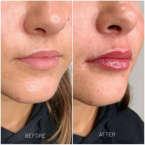 Love At First Pout ♥️