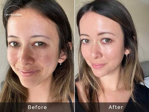 Glass Skin Loading… Glow Up ✨
