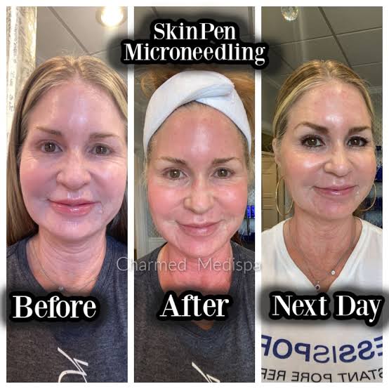 Glass Skin Loading… Glow Up ✨