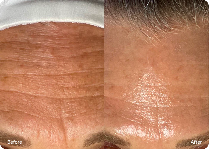 🎄 12 Deals of Christmas: Glow Into 2026! ✨3 Elite HydroFacials for Your Brightest 2026!