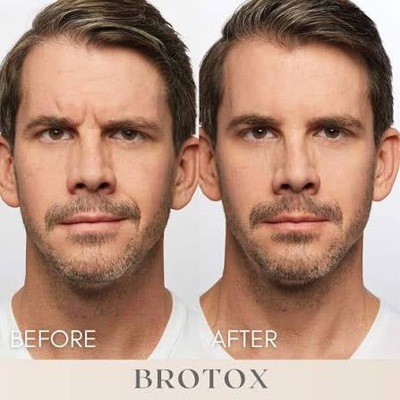 🎄 Full Vial TOX Wrinkle Relaxer + FREE HydraFacial – 12 Deals of Christmas ✨