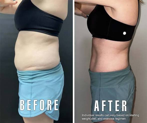 ✨ Keep the Holidays on the Table—Not on Your Waistline With 4 Different GLP Options!