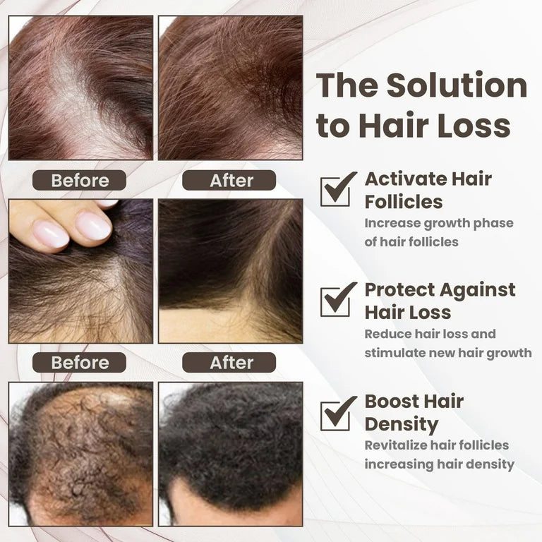 Santa’s Secret to Holiday Hair Growing! Thicker Fuller Hair ♥️